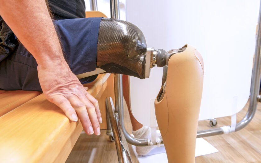 Reha nach Amputation