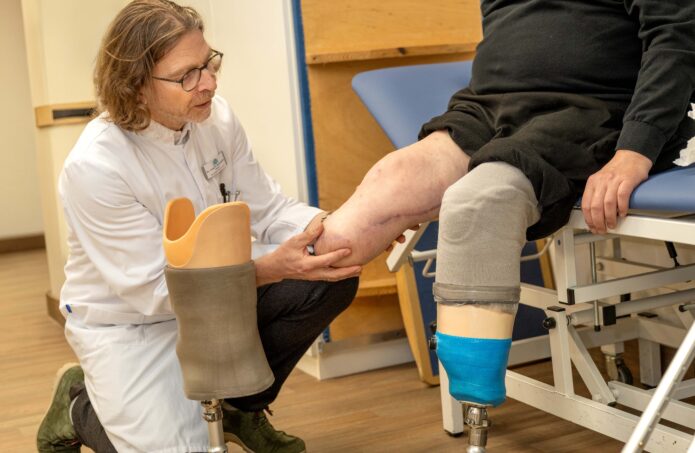 Zurück ins Leben nach Amputation