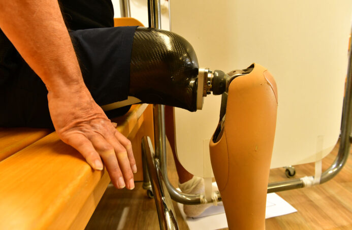 Prothesentechnik sorgt für ein Leben mit Perspektive